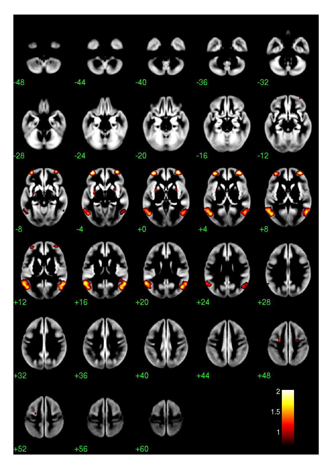 Axial results