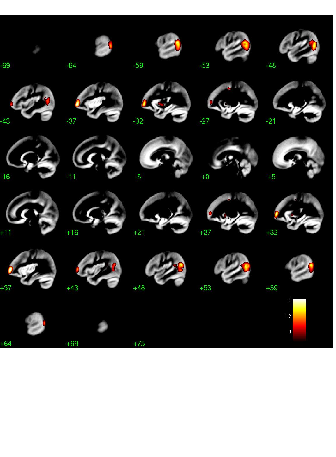 Sagittal results